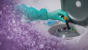 Platelet Rich Plasma Therapy - centrifuge