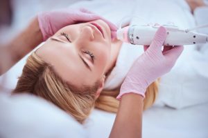microneedling on the face